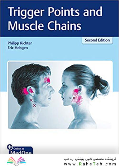 Trigger Points and Muscle Chains