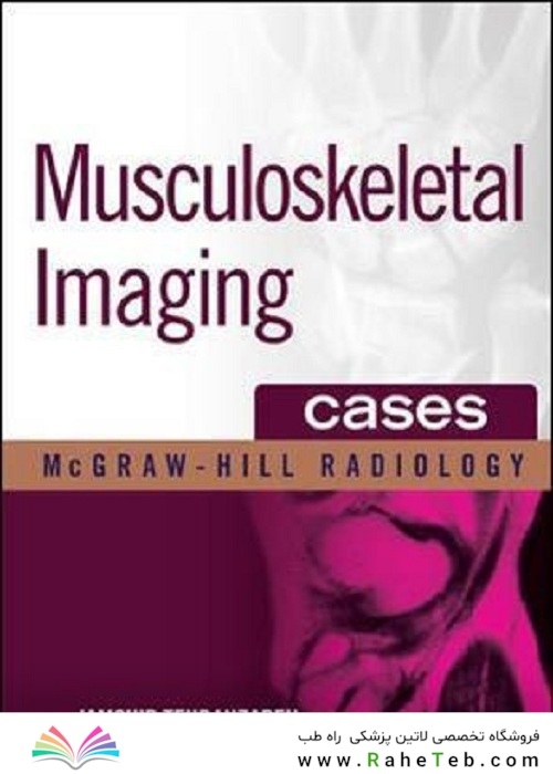  تصویربرداری عضلانی و اسکلتی اسکلت Musculoskeletal Imaging Cases 