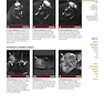  تصویربرداری عضلانی و اسکلتی اسکلت Musculoskeletal Imaging Cases 