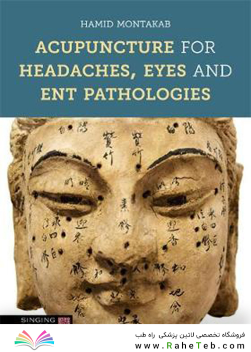 Acupuncture for Headaches, Eyes and ENT Pathologies