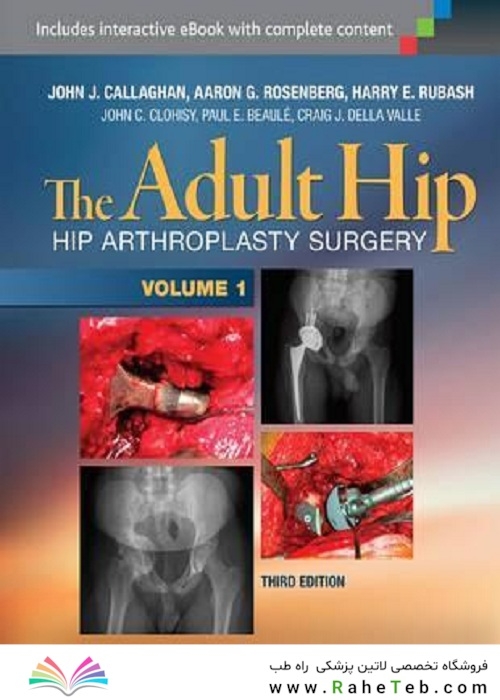 The Adult Hip (Two Volume Set) : Hip Arthroplasty Surgery 2016 هیپ بزرگسالان (مجموعه دو جلدی)