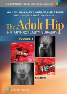 عکس The Adult Hip (Two Volume Set) : Hip Arthroplasty Surgery 2016 هیپ بزرگسالان (مجموعه دو جلدی)