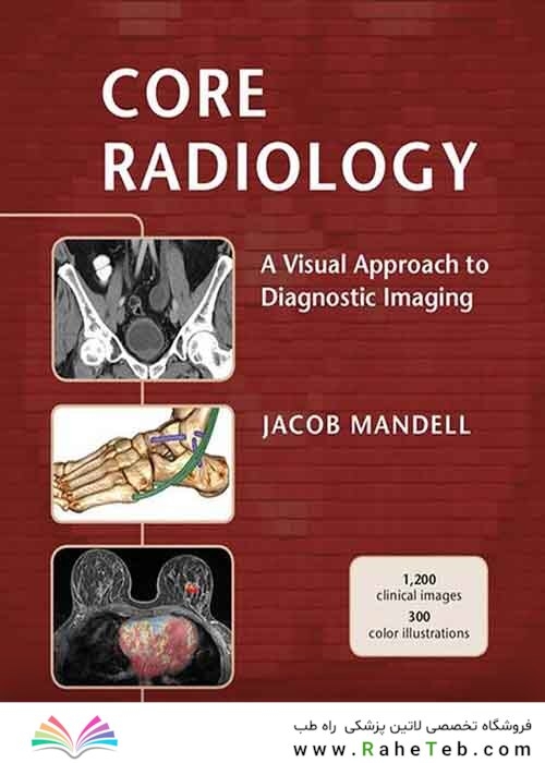 Core Radiology: A Visual Approach to Diagnostic Imaging 1st Edition 2013رادیولوژی هسته