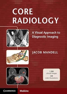 عکس Core Radiology: A Visual Approach to Diagnostic Imaging 1st Edition 2013رادیولوژی هسته
