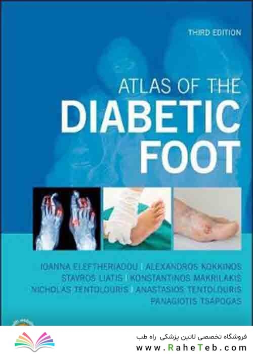 Atlas of the Diabetic Foot 3rd Edition