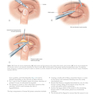 Core Procedures in Plastic Surgery 2nd Edition 2020