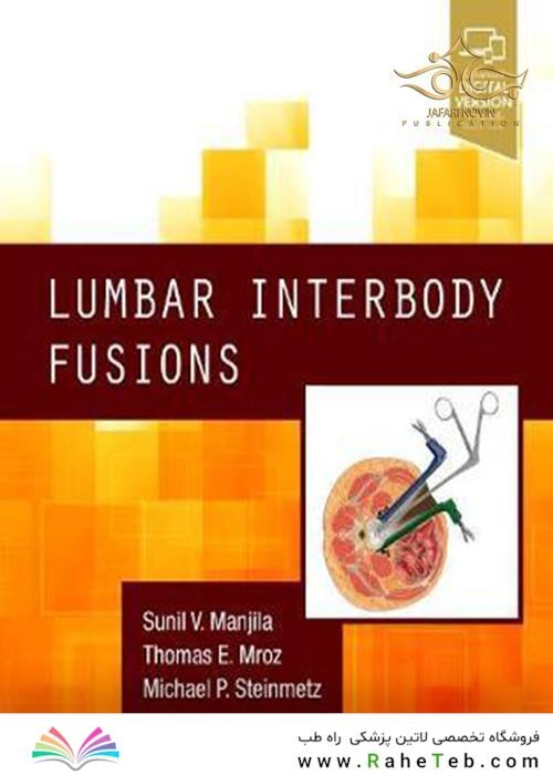  Lumbar Interbody Fusions E-Book 1st Edition, Kindle Edition 2019 حفره های کمری