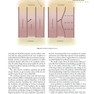 Handbook of Local Anesthesia 7th ed. Edition 2020 کتاب راهنمای بی حسی موضعی