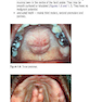Pocketbook of Oral Disease 2012