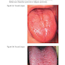 Pocketbook of Oral Disease 2012