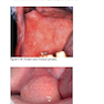 Pocketbook of Oral Disease 2012