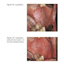 Pocketbook of Oral Disease 2012