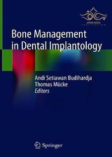 عکس Bone Management in Dental Implantology 1st ed. 2019 Edition