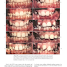 Contemporary Orthodontics 6th Edition 2019