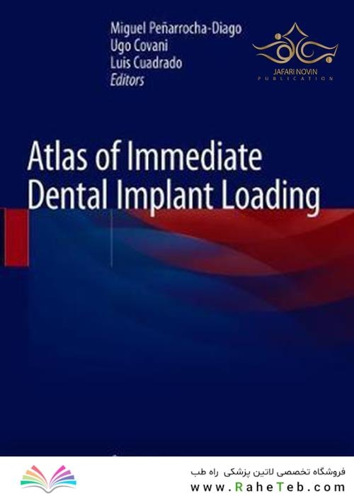 Atlas of Immediate Dental Implant Loading 1st ed. 2019 Edition