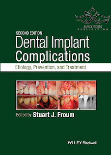 عکس Dental Implant Complications: Etiology, Prevention, and Treatment 2nd Edition