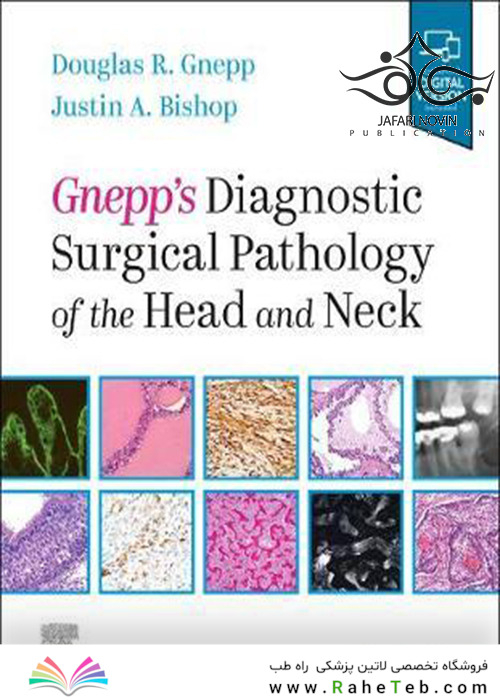 Gnepp