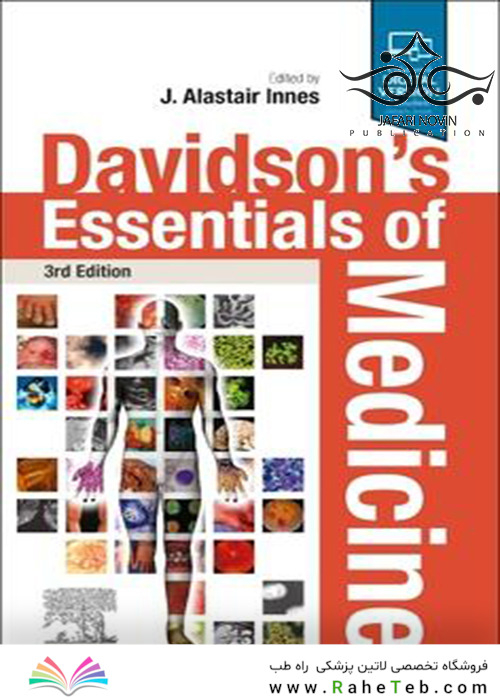 Davidson