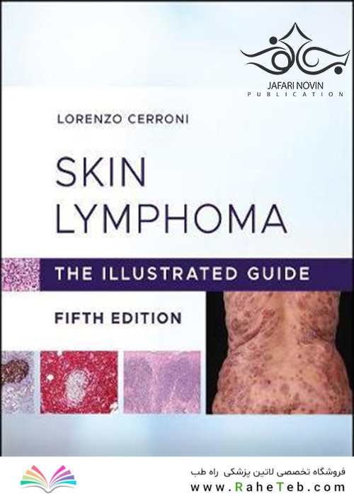 Skin Lymphoma: The Illustrated Guide 5th Edition 2020