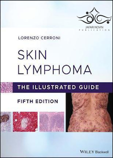 عکس Skin Lymphoma: The Illustrated Guide 5th Edition 2020