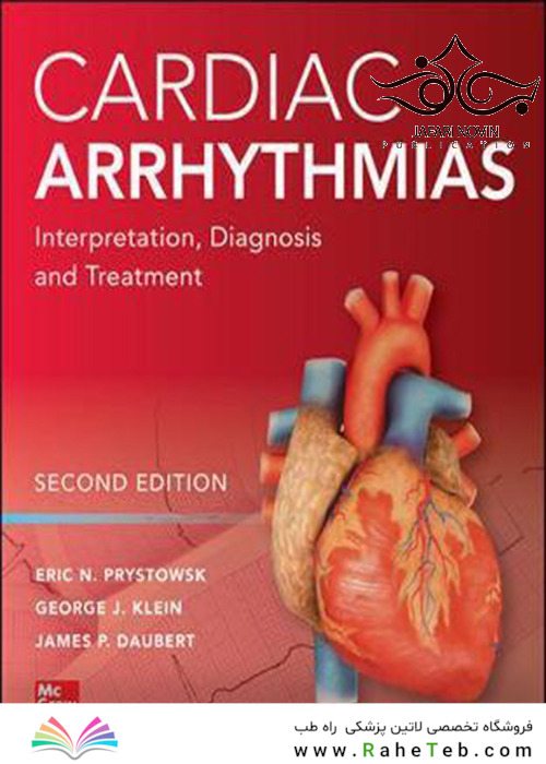 Cardiac Arrhythmias: Interpretation, Diagnosis and Treatment, Second Edition 2nd Edition 2020