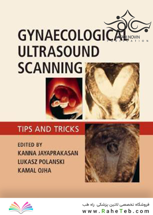 Gynaecological Ultrasound Scanning: Tips and Tricks 1st Edition 2020