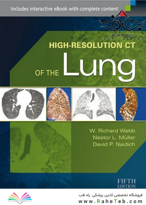 High-Resolution CT of the Lung Fifth Edition2014 سی تی ریه با وضوح بالا
