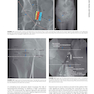 Cardiovascular Intervention, 1st Edition 2015