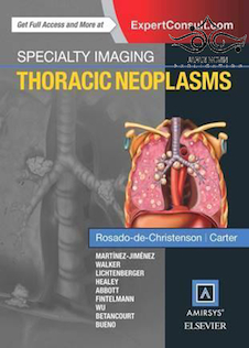 عکس Specialty Imaging: Thoracic Neoplasms 1st Edition2015 تصویربرداری تخصصی: نئوپلاسم های قفسه سینه