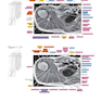 Sectional Anatomy by MRI and CT, 4th Edition2016