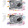 Sectional Anatomy by MRI and CT, 4th Edition2016