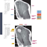 Sectional Anatomy by MRI and CT, 4th Edition2016