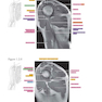 Sectional Anatomy by MRI and CT, 4th Edition2016