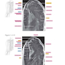 Sectional Anatomy by MRI and CT, 4th Edition2016