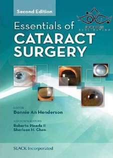عکس Essentials of Cataract Surgery 2nd Edition2014 موارد ضروری جراحی آب مروارید