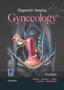 عکس Diagnostic Imaging: Gynecology, 2th Edition2015 تصویربرداری تشخیصی: زنان