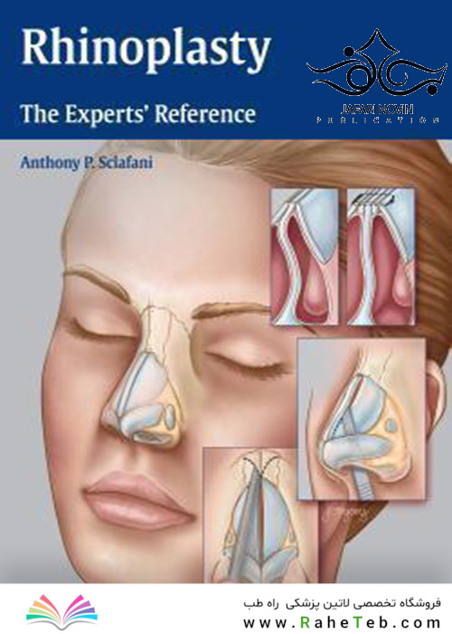 Rhinoplasty: The Experts’ Reference 1st Edition2015 جراحی زیبایی بینی: مرجع متخصصان