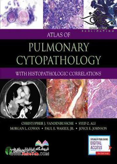 Atlas of Pulmonary Cytopathology 1st Edition2017 اطلس سیتوپاتولوژی ریوی