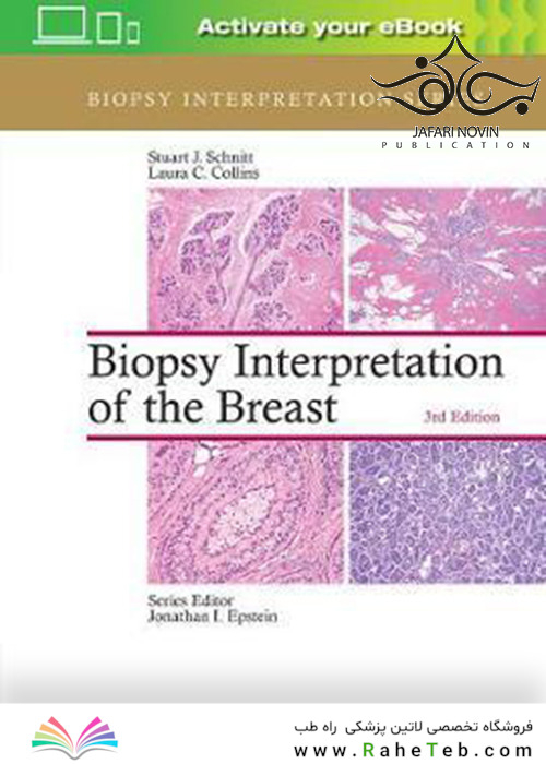 Biopsy Interpretation of the Breast, Third Edition 2017