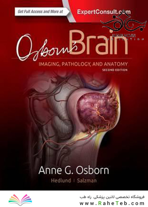 Osborn’s Brain, 2nd Edition2017