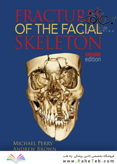 Fractures of the Facial Skeleton 2nd Edition2015 شکستگی اسکلت صورت