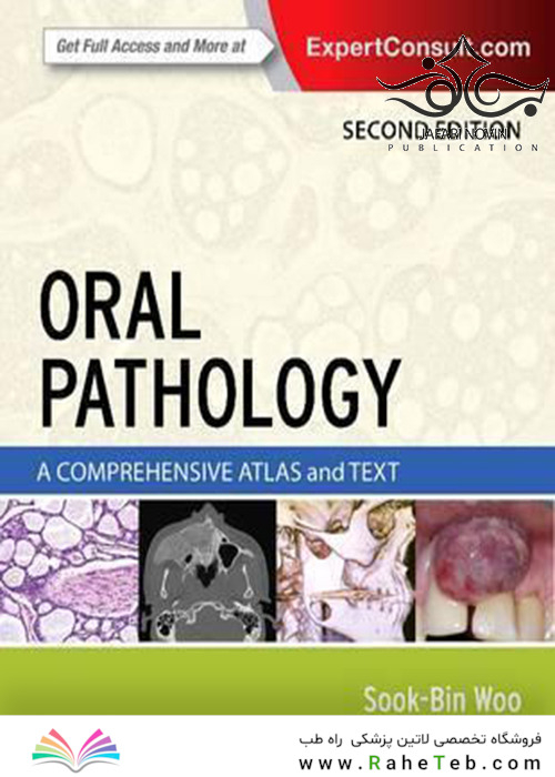 Oral Pathology, 2nd Edition2016 آسیب شناسی دهان و دندان