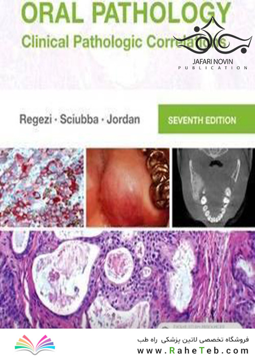 Oral Pathology: Clinical Pathologic Correlations 7th Edition2016 آسیب شناسی دهان و دندان