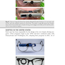 Advances in Ophthalmology and Optometry 1st Edition 2022
