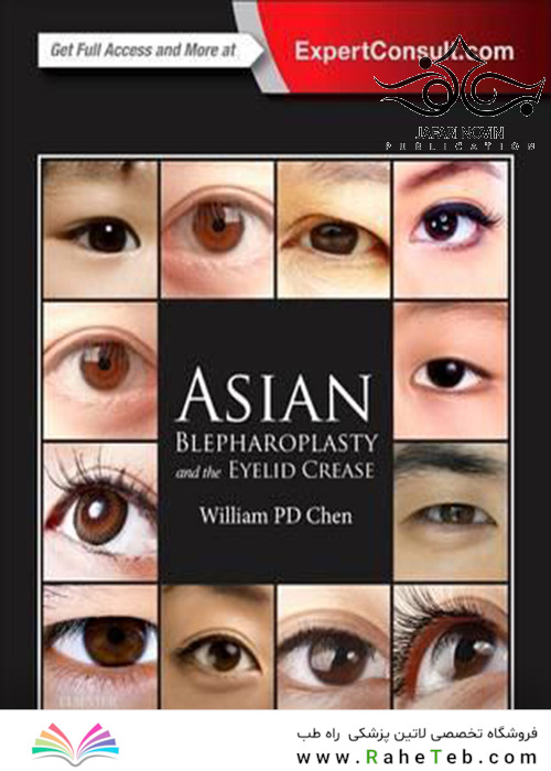 Asian Blepharoplasty and the Eyelid Crease 3rd Edition