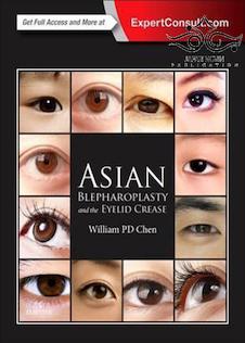 عکس Asian Blepharoplasty and the Eyelid Crease 3rd Edition