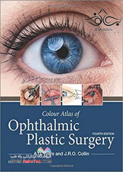 Colour Atlas of Ophthalmic Plastic Surgery 4th Edition2017