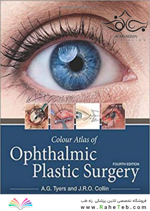 Colour Atlas of Ophthalmic Plastic Surgery 4th Edition2017