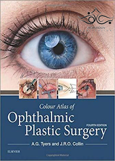 عکس Colour Atlas of Ophthalmic Plastic Surgery 4th Edition2017