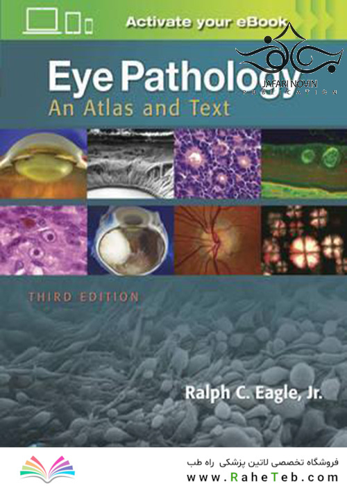 Eye Pathology, 3th Edition2016 آسیب شناسی چشم